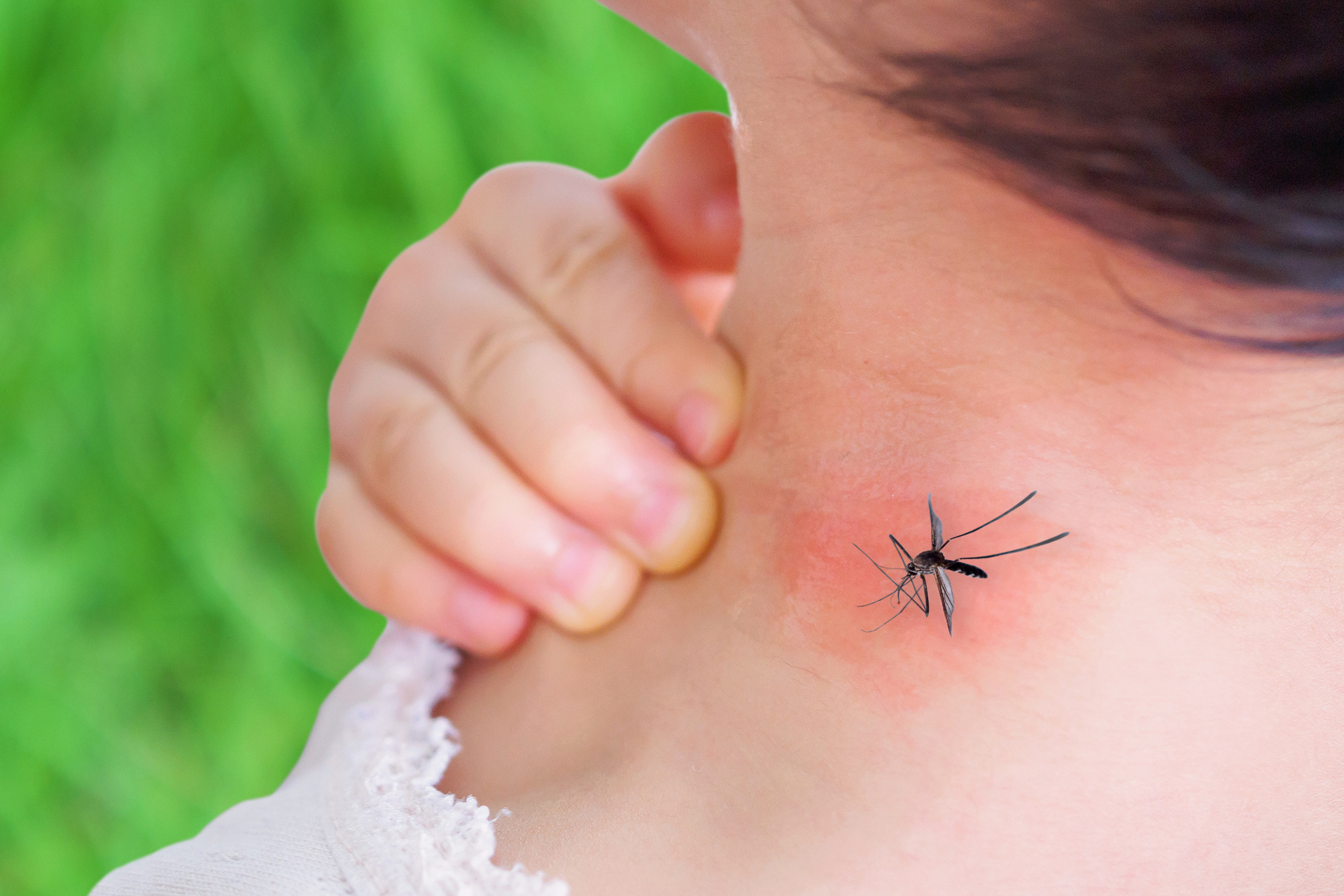 аллергия на комаров